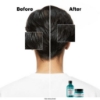 Picture of LP SERIE EXPERT SCALP ADVANCED ANTI-OILINESS SHAMPOO 300ML