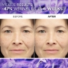 Picture of L'Oréal Paris Revitalift Filler 1.5% Pure Hyaluronic Acid Serum 30mL