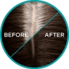 Picture of L'Oréal Paris Magic Retouch Temporary Root Concealer Spray - 2 Dark Brown