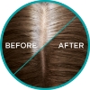 Picture of L'Oréal Paris Magic Retouch Temporary Root Concealer Spray - Cool Brown (Instant Grey Hair Coverage)