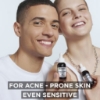Picture of Garnier Skin Active AHA+BHA Charcoal Anti-Imperfection Serum 30ml